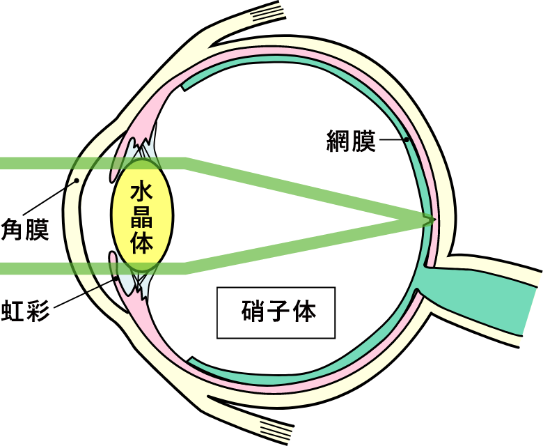 正常な目